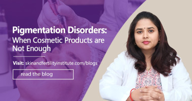 Pigmentation Disorders: When Cosmetic Products Are Not Enough