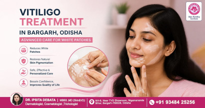 Vitiligo Treatment in Bargarh, Odisha | Advanced White Patch Treatment at Skin-Fertility Institute